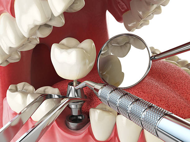 Best Pediatric Emergency Dentist in Woodland Park, NE